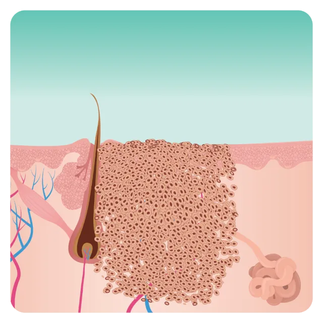 figure 1 skin lesion 1024x1024 1 1