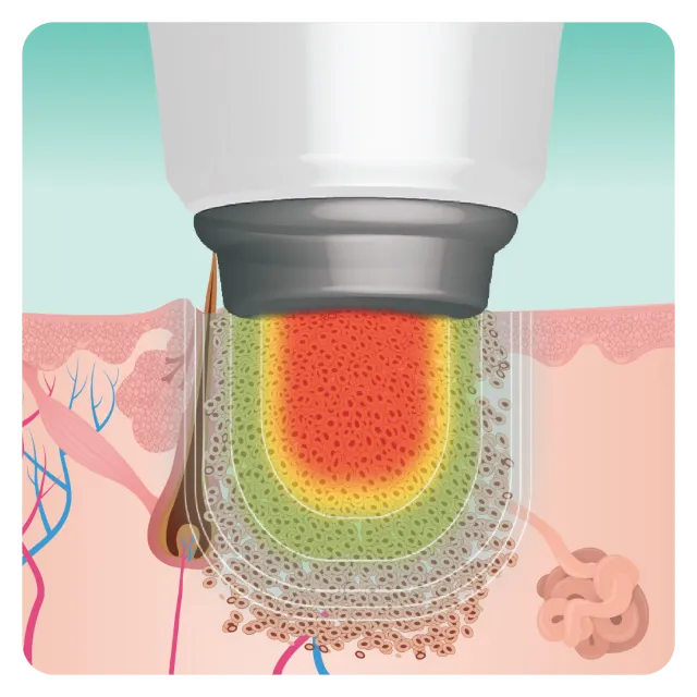 figure 2 treatment 1024x1024 1 1